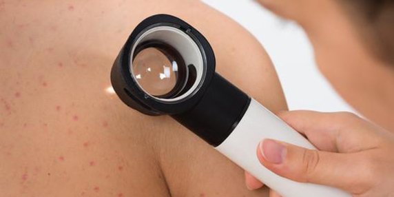Derma grande