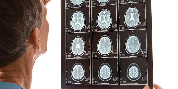 Neuro grande